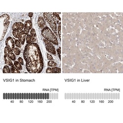VSIG1 Antibody, Novus Biologicals 0.1mL; Unlabeled:Antibodies, Polyclonal